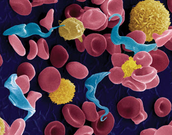 trypanosomiasis in blood